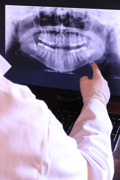 Best Emergency Tooth Extraction in Delisle, MS
