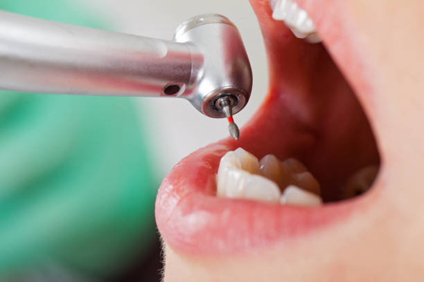 Best Emergency Treatment for Toothache in Delisle, MS